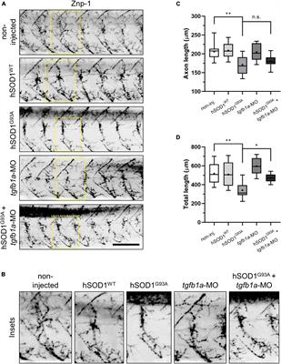 Knockdown of tgfb1a partially improves ALS phenotype in a transient zebrafish model